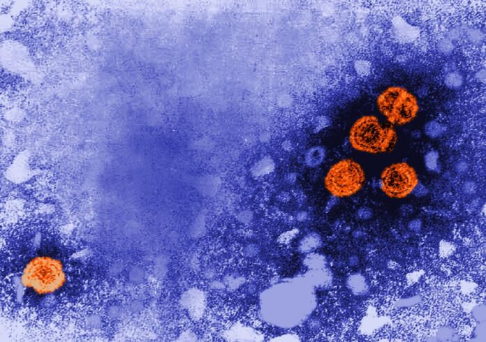 Viriones de la hepatitis B (de color naranja)